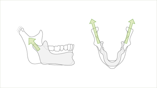 5 口の成長と歯並び 石神井公園の歯科と矯正歯科 歯医者 口腔外科 練馬区石神井公園 大泉学園