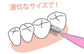 サイズの合った歯間ブラシ
