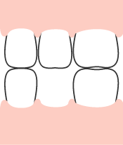 周辺の歯の移動